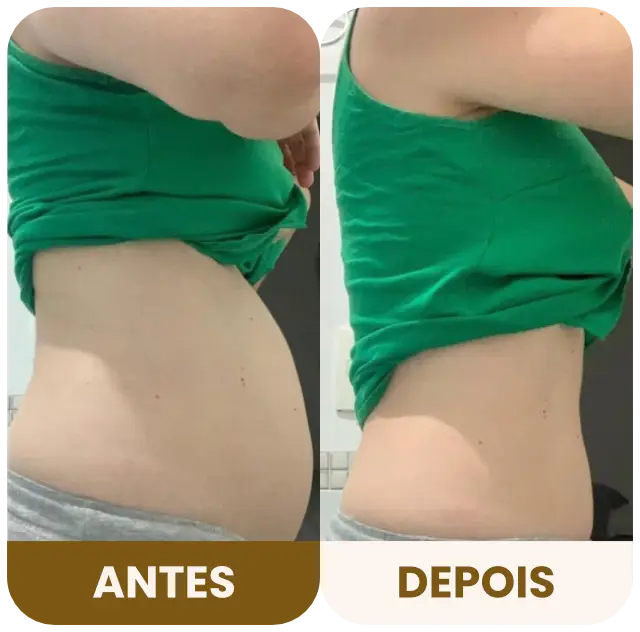 DBRP - Antes e depois 01