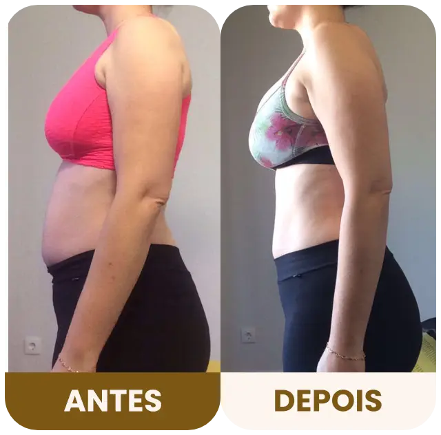 DBRP - Antes e depois 02