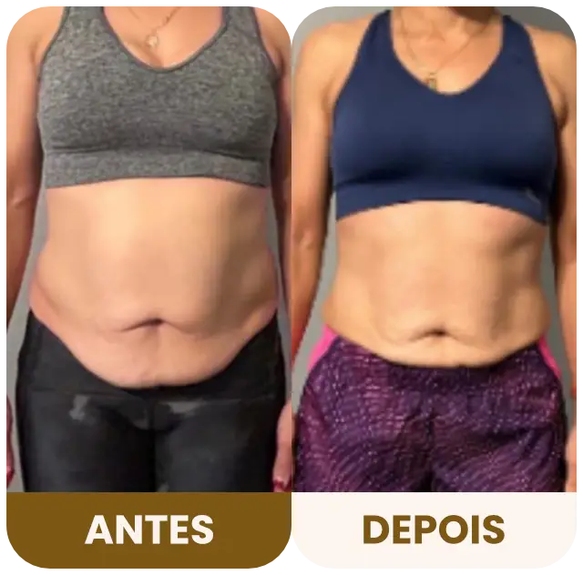 DBRP - Antes e depois 03