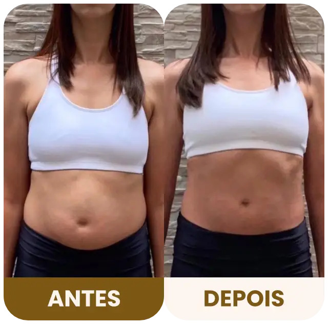 DBRP - Antes e depois 04