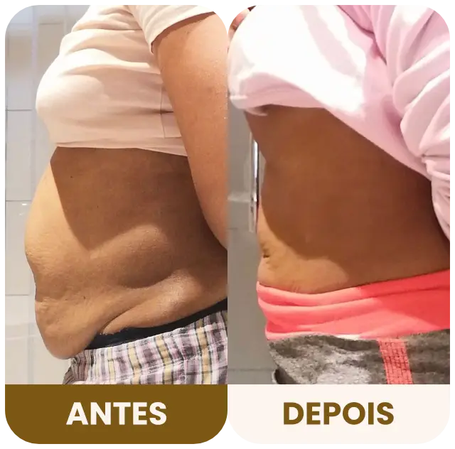 DBRP - Antes e depois 05