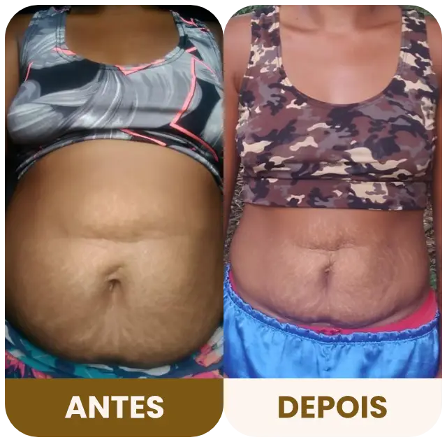 DBRP - Antes e depois 06